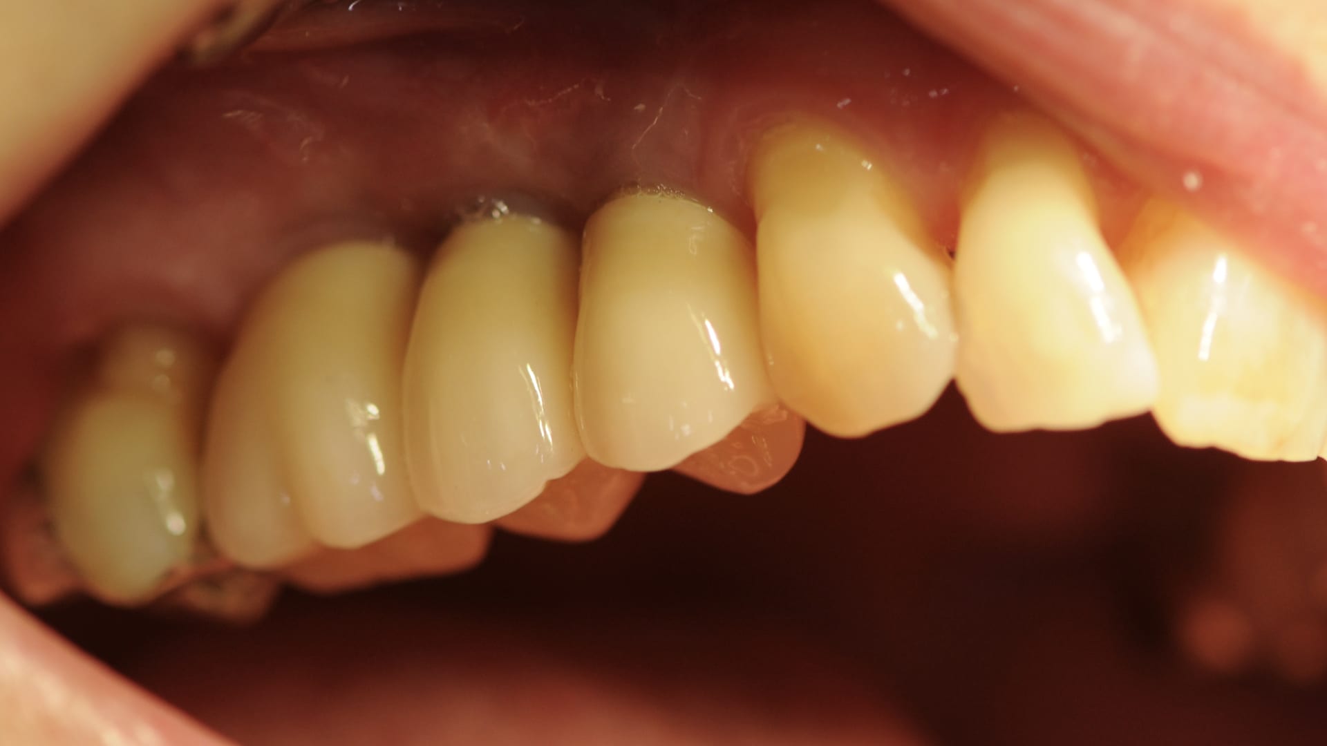 Abb. 19: Abschlussbild