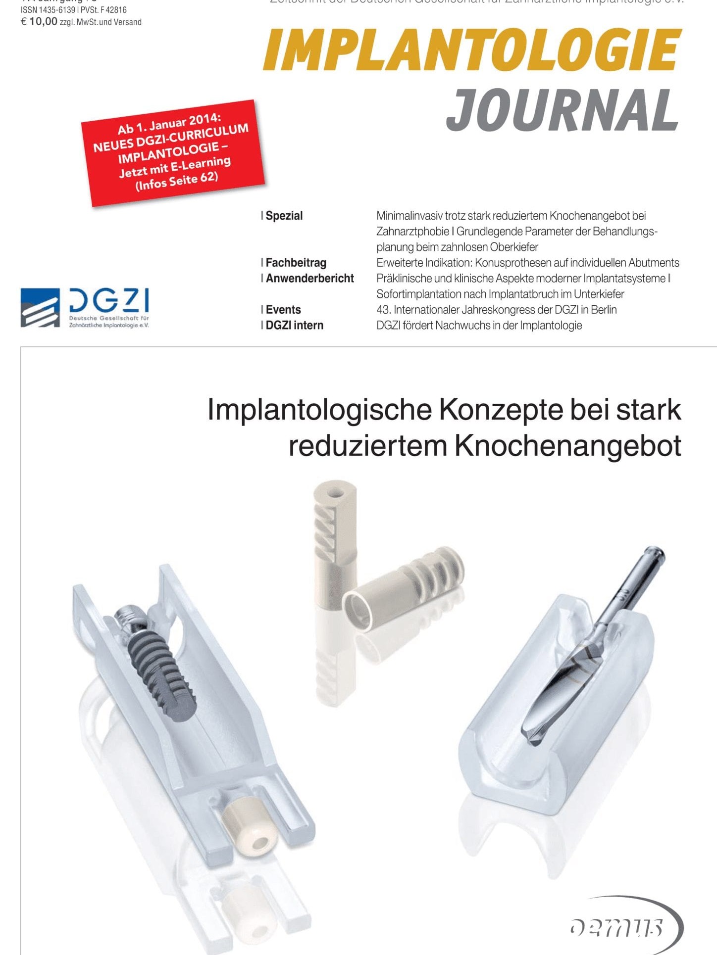 Deckblatt Implantologie Journal 08_2013
