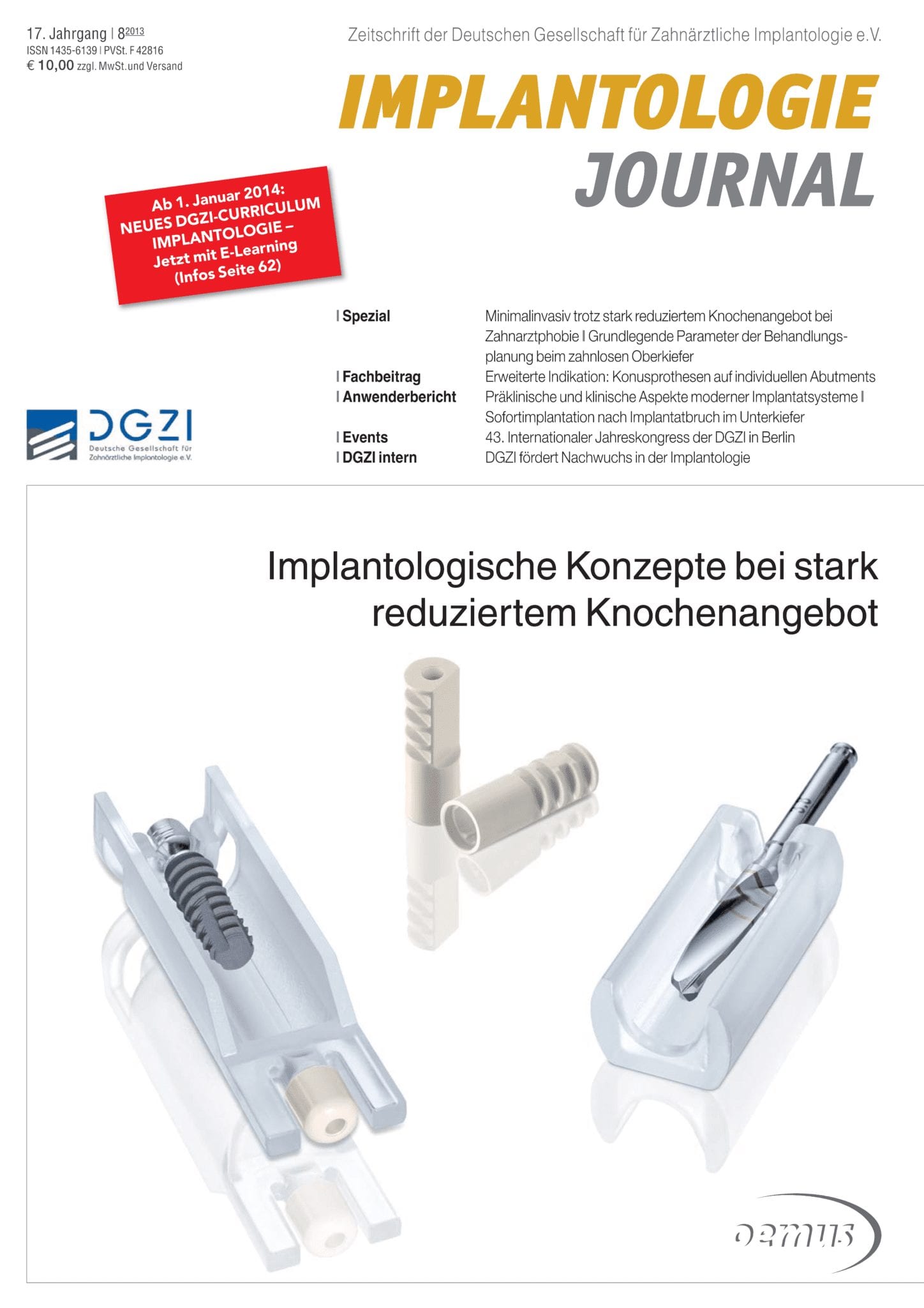 Deckblatt Implantologie Journal 08_2013