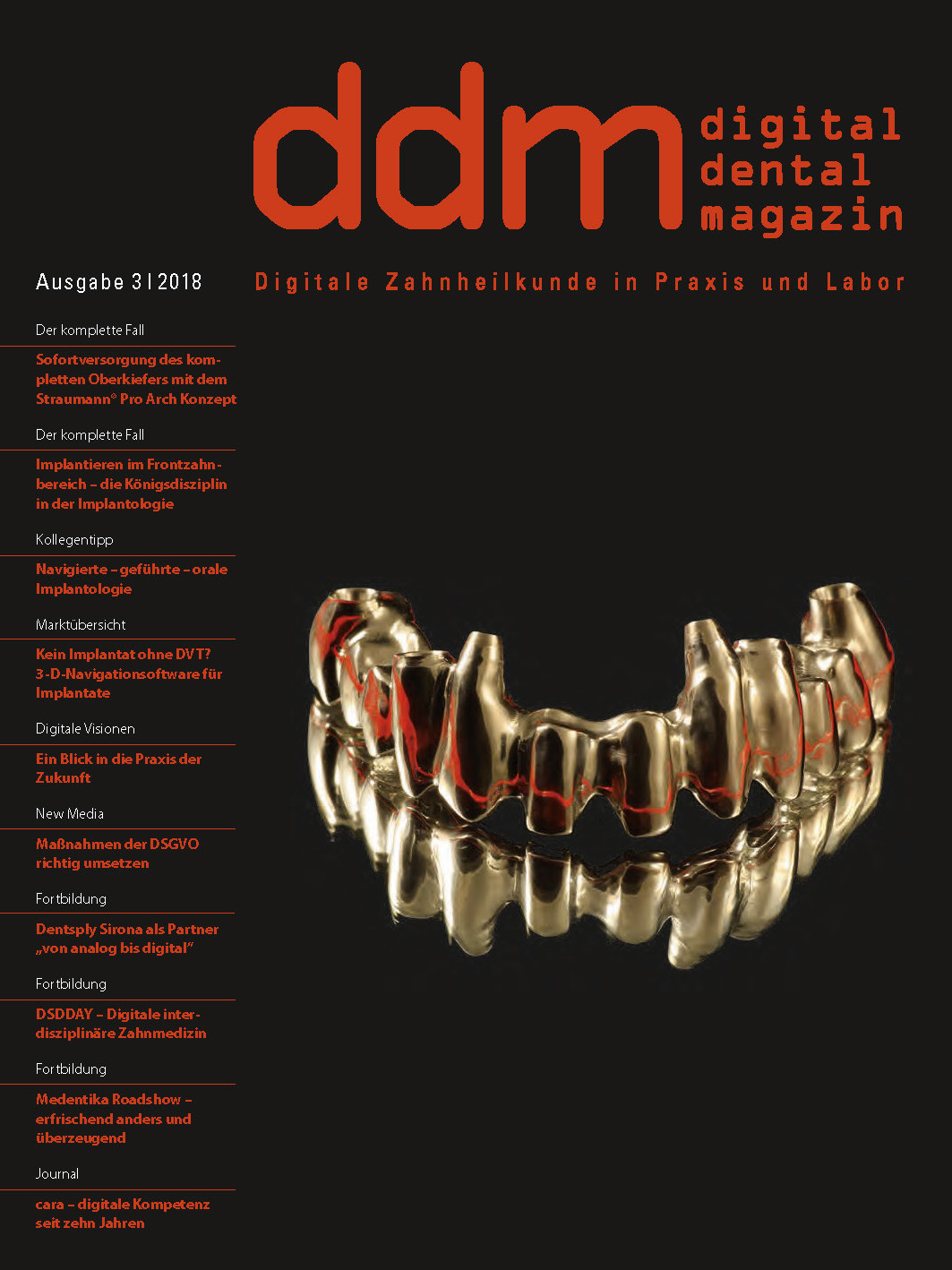 Implantieren im Frontzahnbereich ddm 3_2018