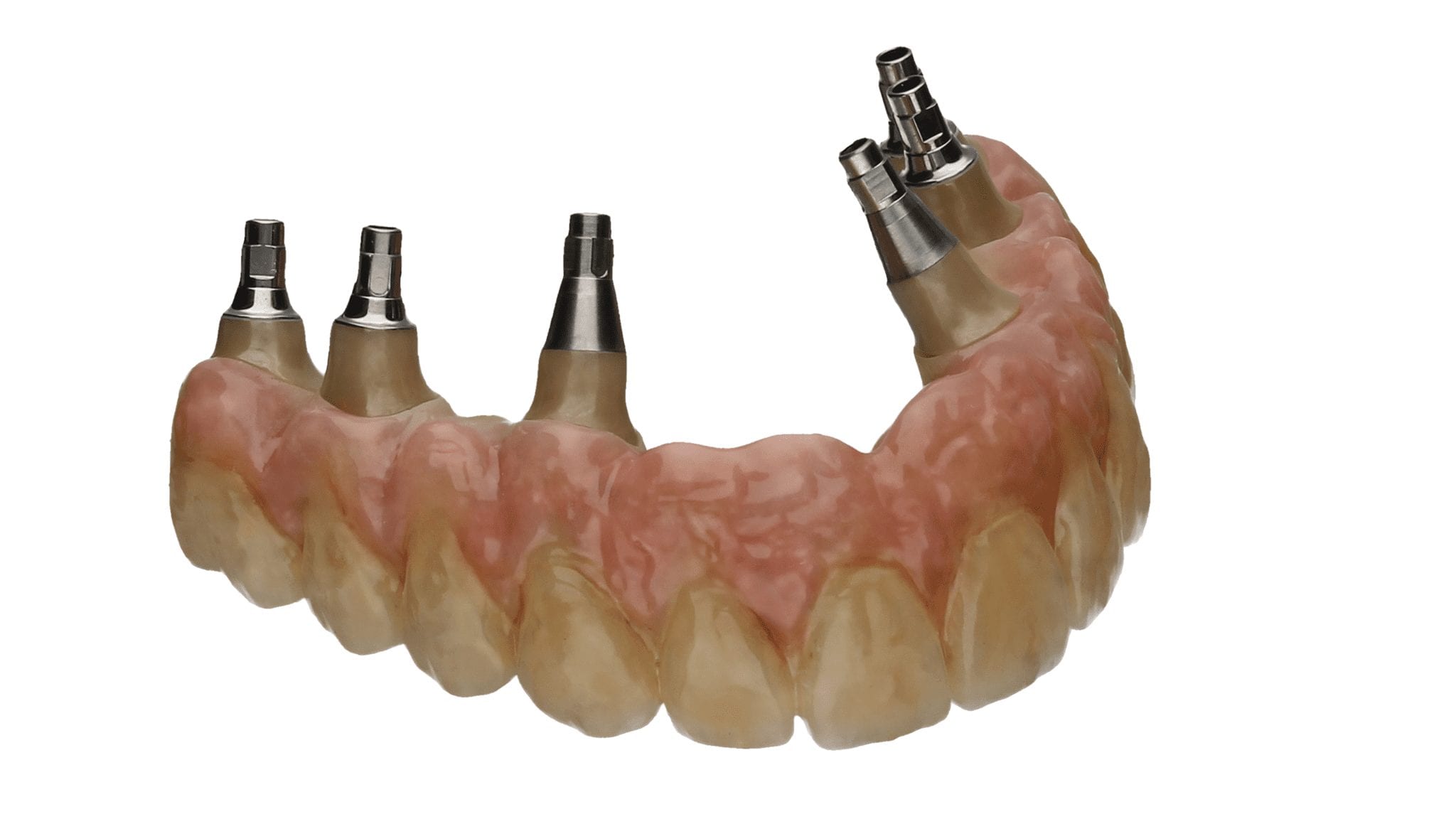 Vollverblendete Brücke