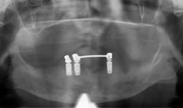 OPG der Ausgangssituation