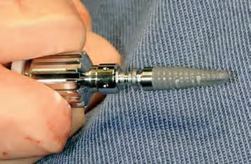 SPI Contact RC-Implantat von Thommen Medical