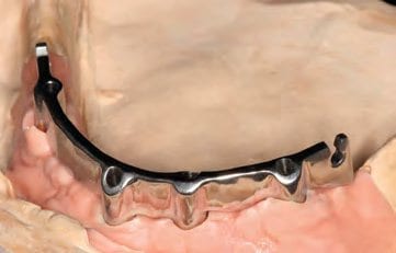 ...auf dem Meistermodell