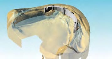 ...erfolgt erst nach erteilter Freigabe