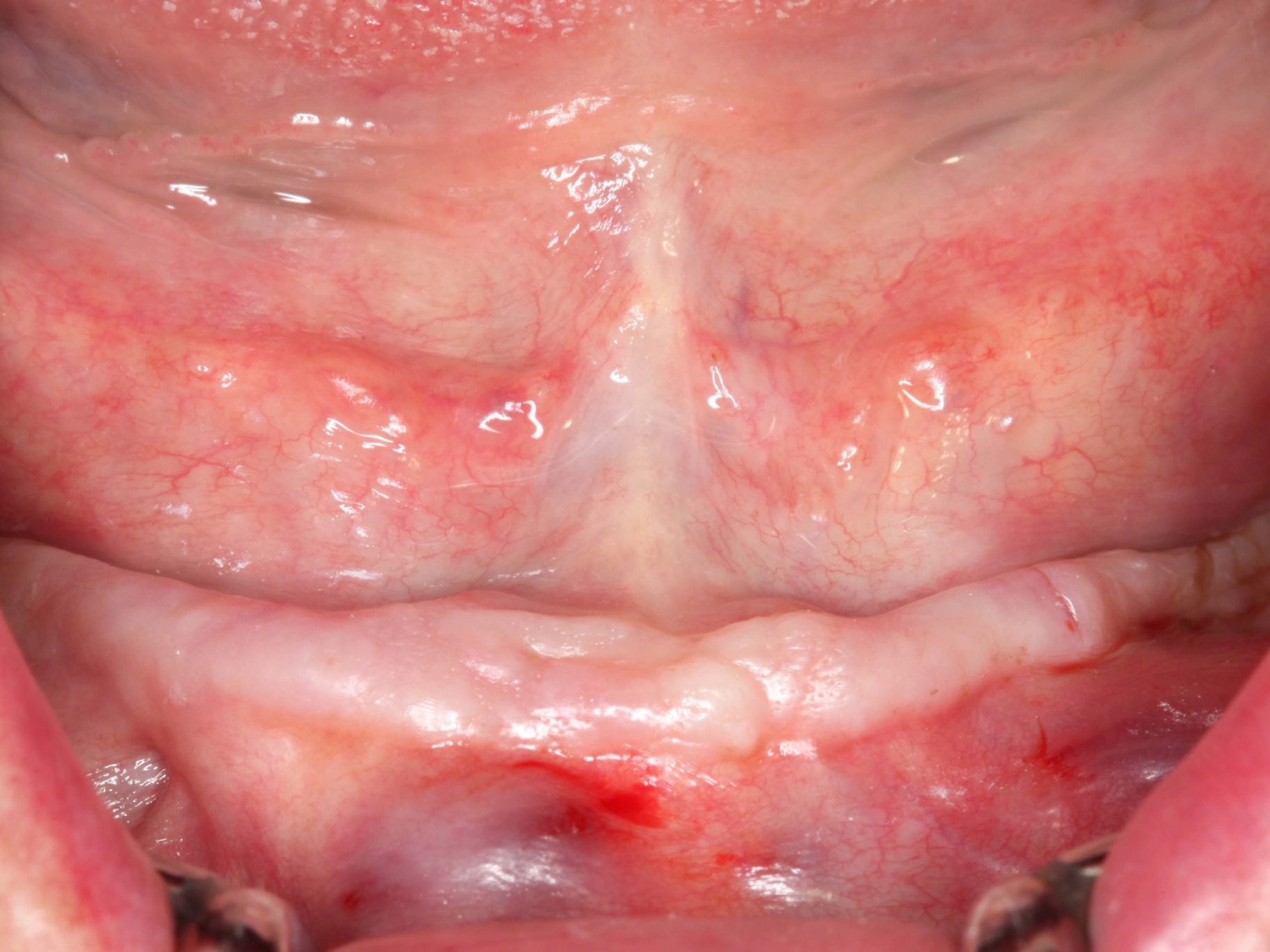 Abb 2 Klinische Ausgangssituation