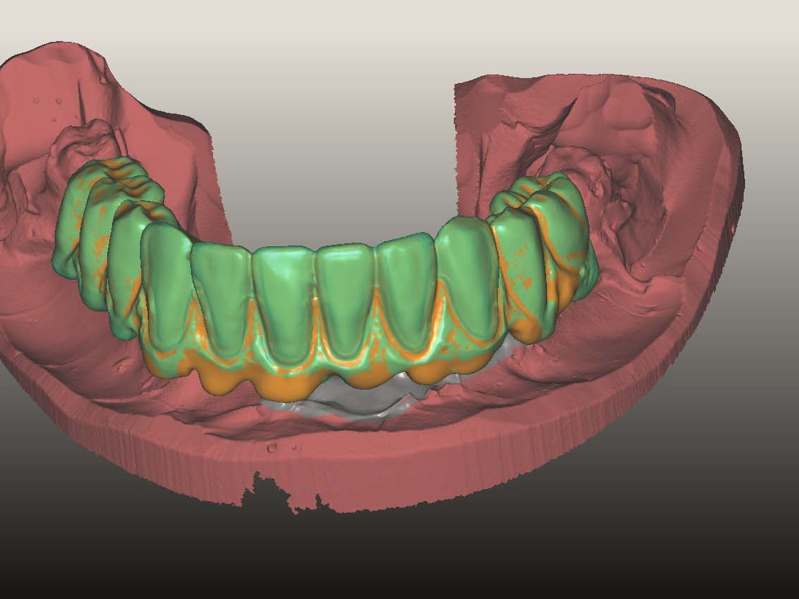 Abb 24 Design der Prettau®-Bridge im CAD-Programm