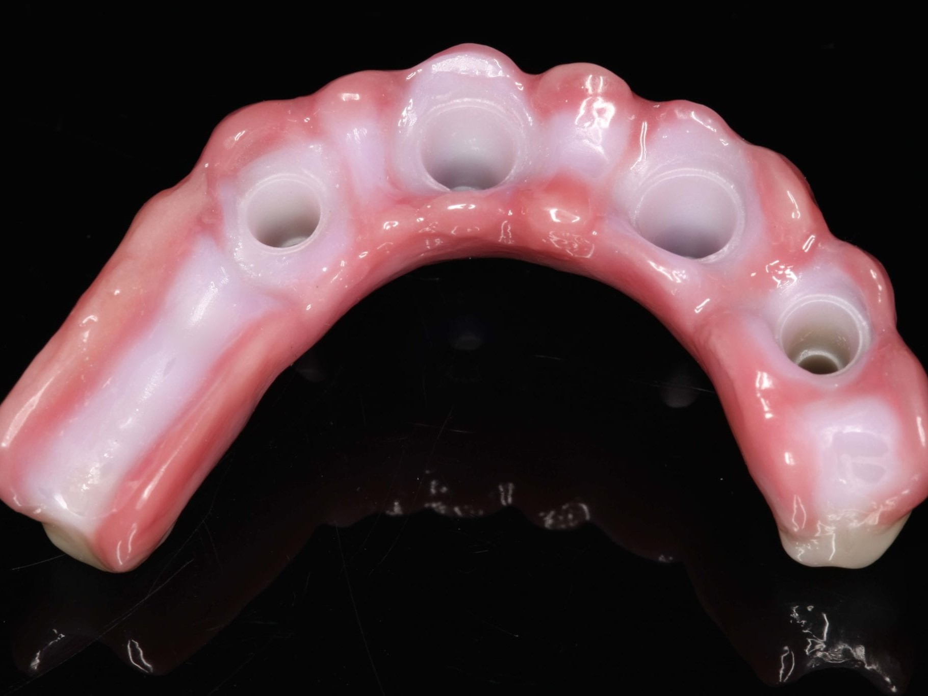 Abb 27 Impressionen der fertigen Arbeit von basal