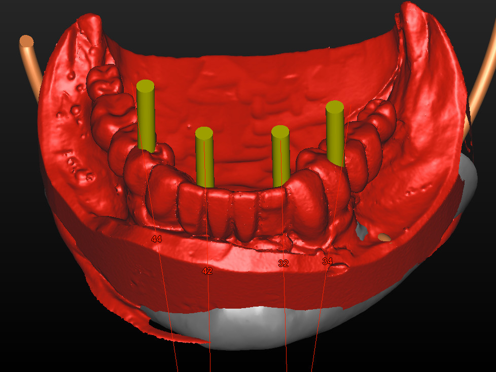Abb 4 Situationsscan