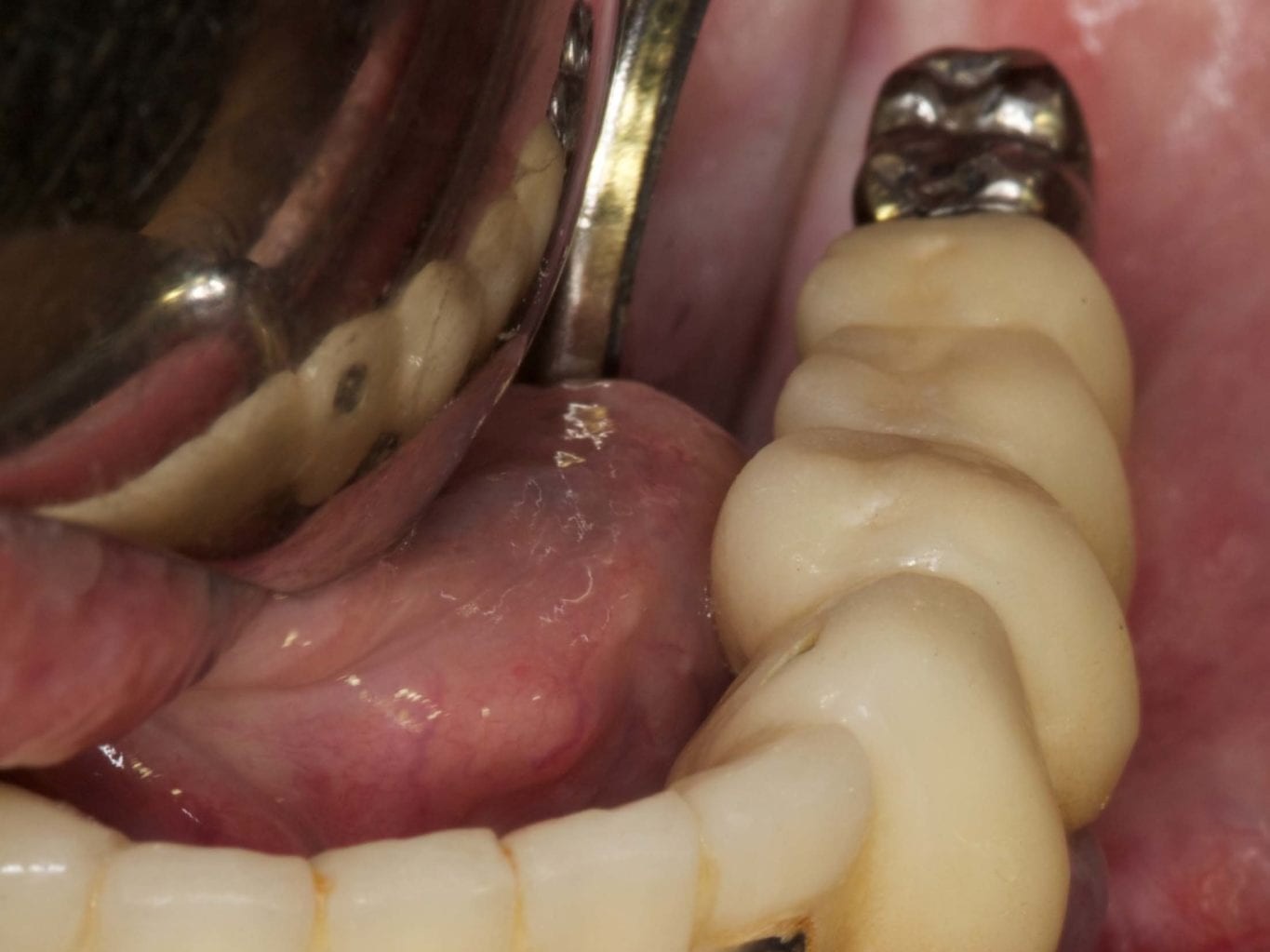 Abb 7 klinische Ausgangssituation links