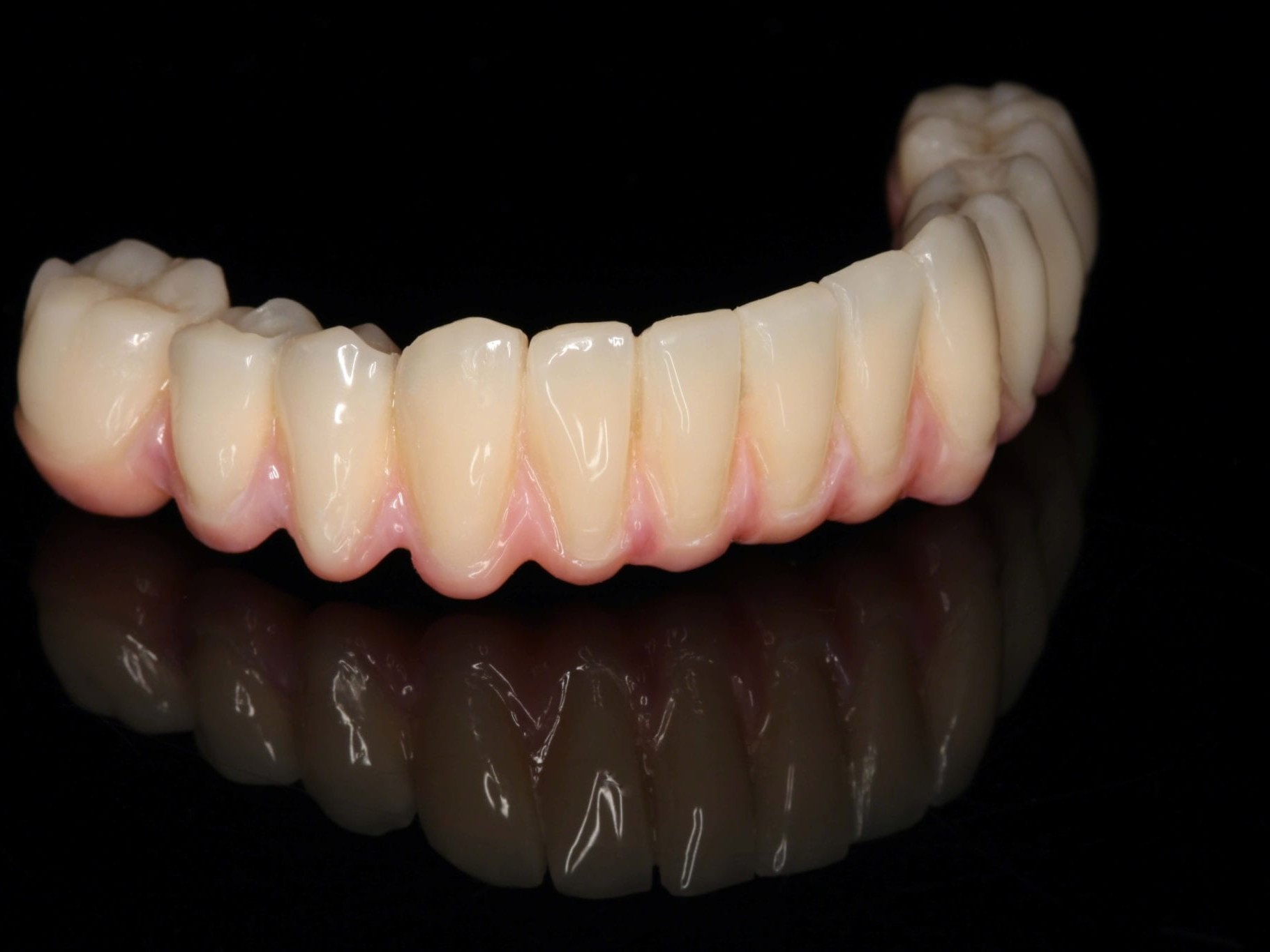 Abb. 8 vestibuläre Ansicht der definitiven Arbeit