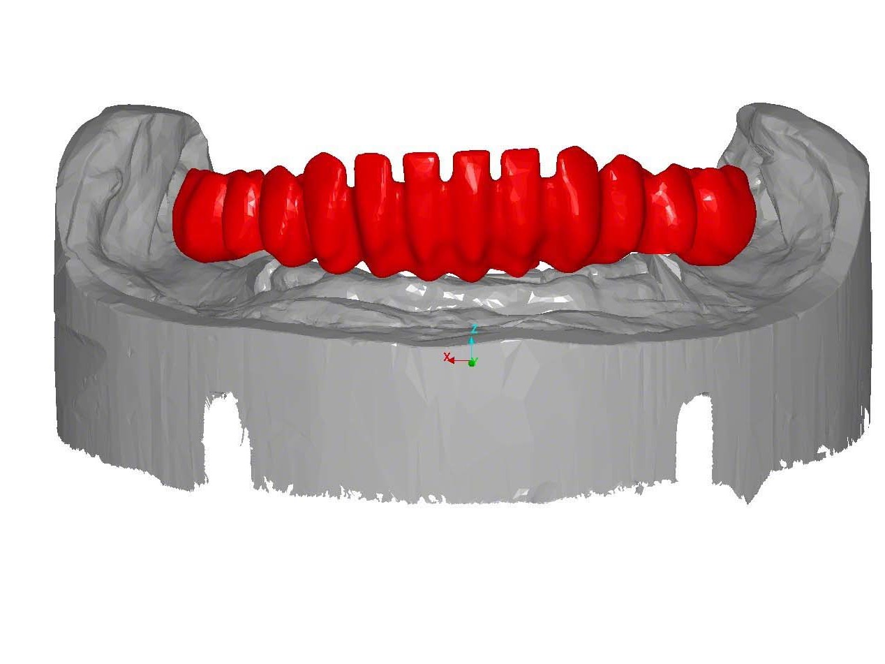 Abb. 3 designtes Gerüst