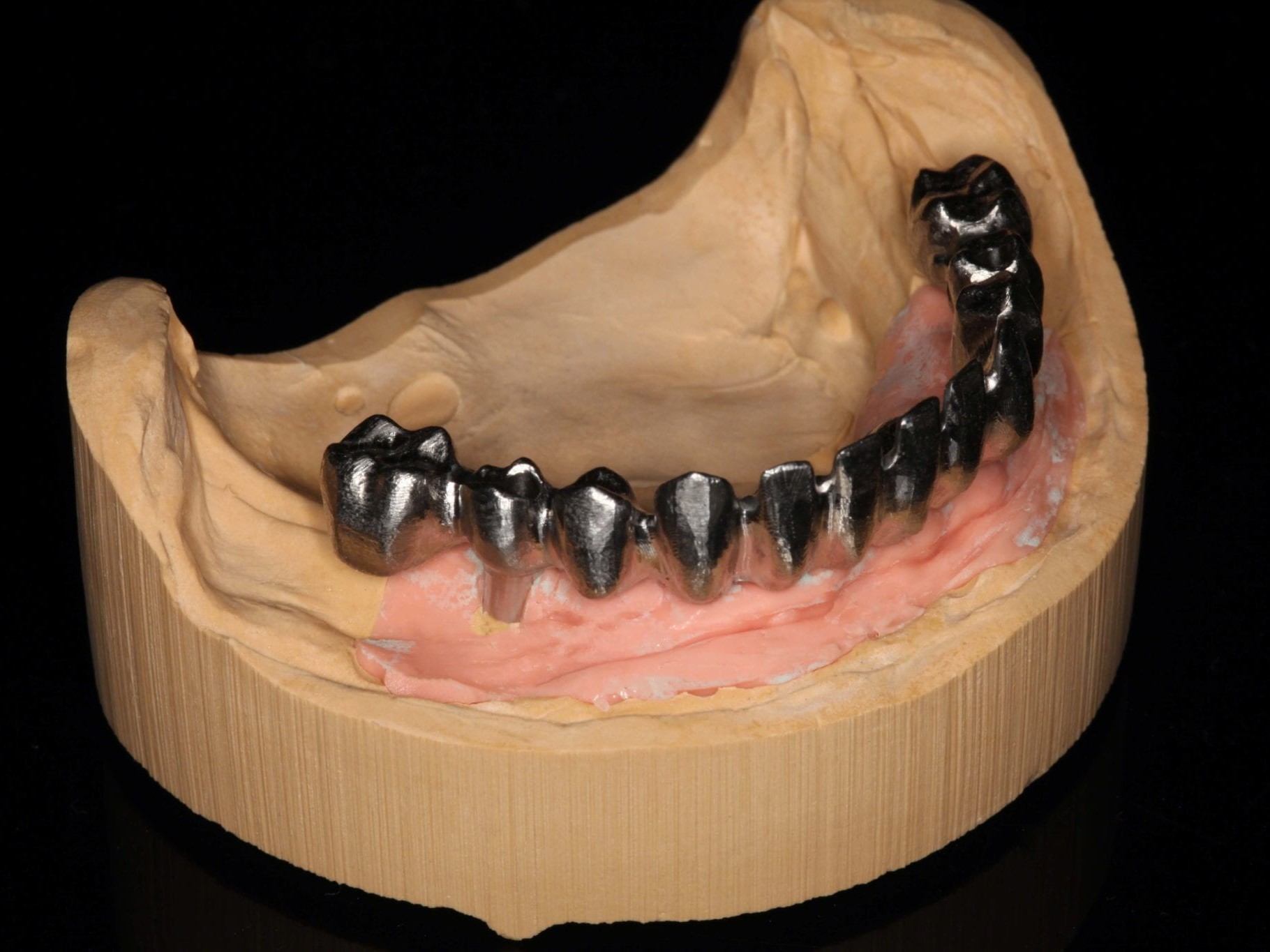 Abb. 4 Titangerüst auf dem Meistermodell