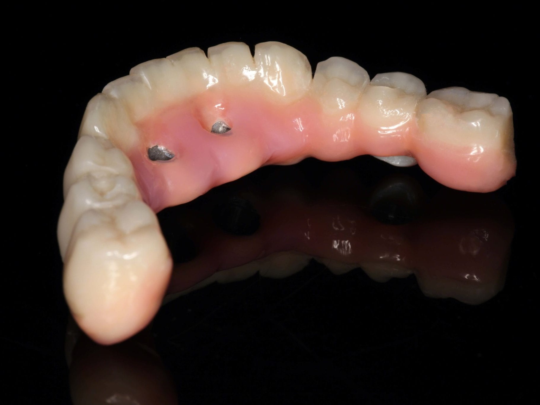 Abb. 7 orale Ansicht der definitiven Arbeit