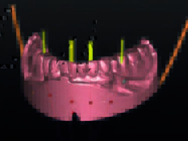 Das gematchte Situationsmodell