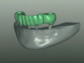Fertiggestellte Modellation im CAD-Programm