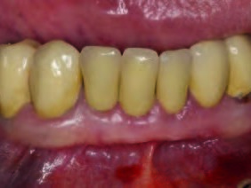 Klinische Ausgangssituation