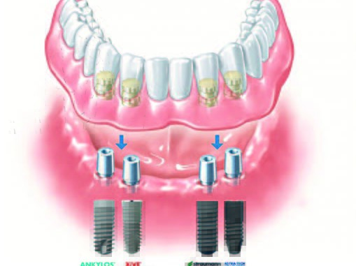 Planung des SynCone-Konzepts