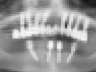 Postoperatives Orthopantomogramm