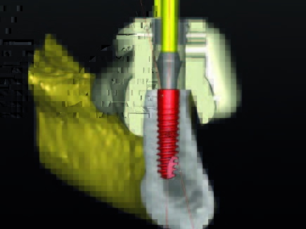 Querschnitt durch die Planung