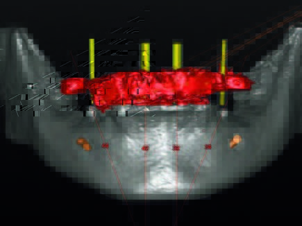Segmentierter und geplanter Datensatz