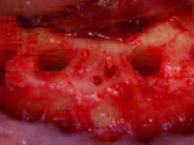 Zustand nach dem Gewindeschnitt