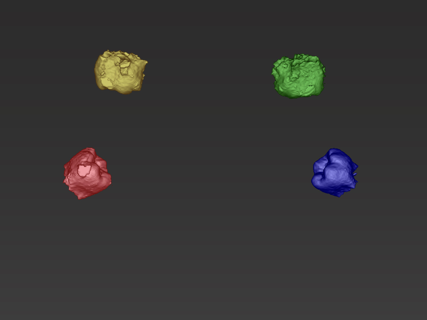 Segmentierte Zähne 18, 28, 38 und 48