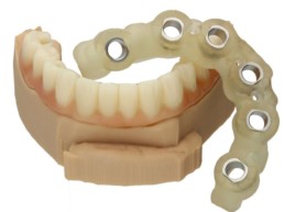Smile in a Box Zinser Dentaltechnik Straumann BLT