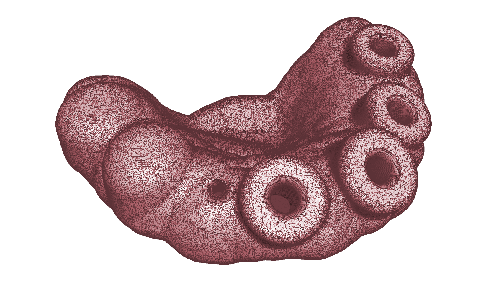 Gitternetzmodell einer ZinserGuide-Bohrschablone